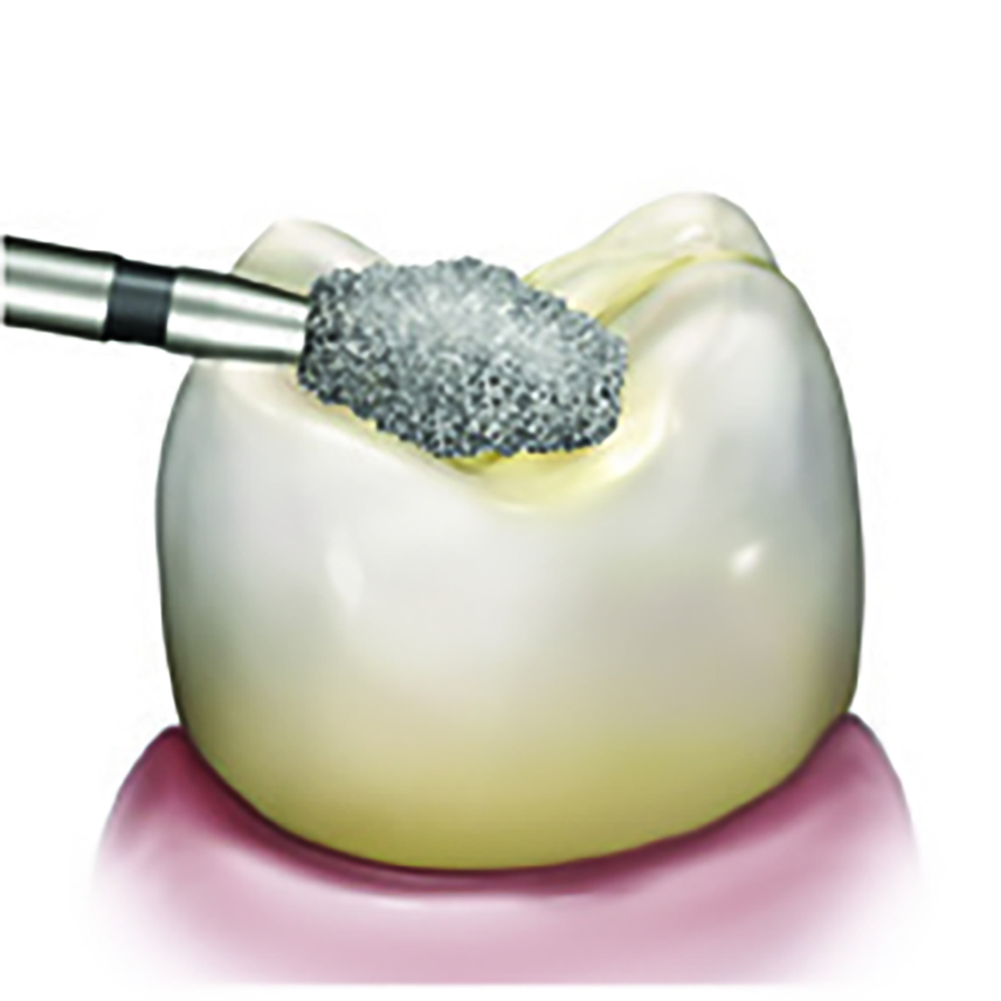 REVELATION DIAMOND 811-033 - Image 2